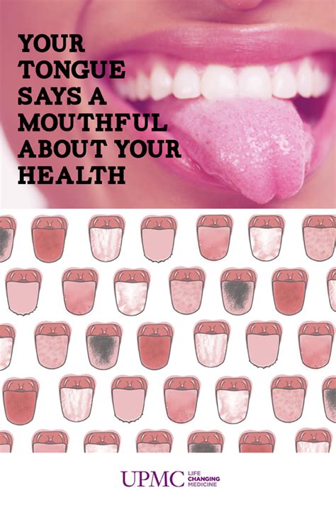 tounge|What Your Tongue Says About Your Health